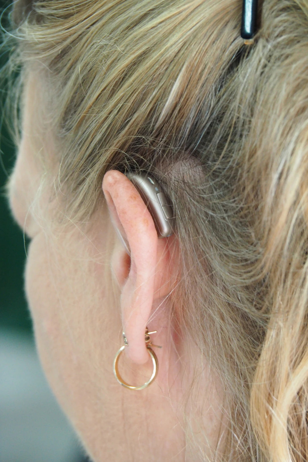The Key to Sound: Discovering the Role of Audiologists in Hearing Aid Selection