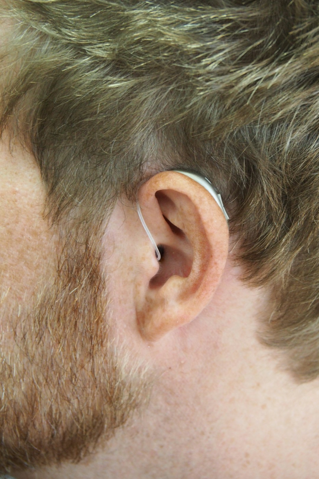 Dispelling Common Myths About Hearing Aids